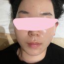 하임메디 | 데자뷰메디스킨 서면피부관리 직장인피부관리 가능한곳 부산피부관리샵 추천 트러블 여드름 진정관리...