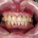 여치과기공소 이미지