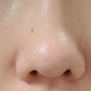 슈링