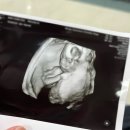 연세봄산부인과의원 이미지