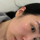 (주)에스티메디 | 부산에스테틱 동래피부관리, 더노블메디센터에서 받은 베르도소 관리 솔직 후기!