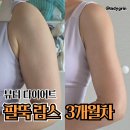 양이멍이 | 40대 중반 팔뚝 람스 3개월차 둘레 -7cm 솔직후기 (통증, 가격, 후관리)