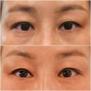 프리뷰티셀플라 이미지