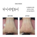에스엠 뷰티 | 부천 신중동 에스테틱 라비에벨뷰티 등슬리밍 수기관리 후기