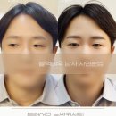 여우눈썹