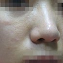 자글자글 이미지