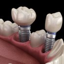 자연이바른치과의원 이미지