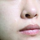 비트케어 이미지