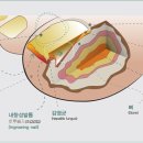 러블림네일
