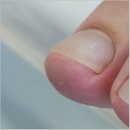 동춘동 홈프러스 | 인천 연수구 송도 동춘동 내성발톱 고퀄리티 관리 에이풋케어 추천