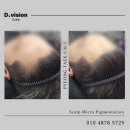 디비전 스칼프 이미지