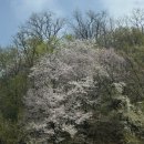 박동수외과의원 | [임신일기] 임신7주 태아 심장소리 확인 그리고 혈액검사 및 유방혹 조직검사 결과 확인