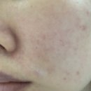 똘레랑스 헤어 이미지