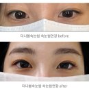 더나 | 호원동 속눈썹 연장 망월사역 더나봄속눈썹 jc컬 10mm