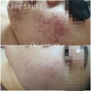 성내동 피부관리 유나에스테틱 위치.가격.시간.후기