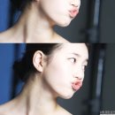 온더바디테라피 이미지
