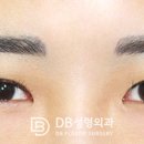 더블픽스