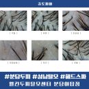 분당두피 두피관리 탈모관리 웰킨두피탈모센터 분당야탑점 딥톡스 헤드스파후기
