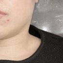 스페셜성형외과의원 | [솔직후기] 소프웨이브 성지라고 해서 찾아간 찐 후기! 잔주름 파괴범😎