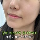 갈매동 뷰티엔제이 구리 유일한 티리온엑스 에스테틱 예신관리 후기