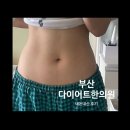 함한의원 | 부산 해운대한의원 내돈내산 2주차 후기 (4일만에 1.5kg감량) | 한방 다이어트한약 가격, 부작용