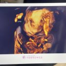 (주)우리기연 | 임신 20주 2차 정밀초음파 후기 태동 시작 철분제 변비까지