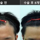 연세모나의원 네이버블로그