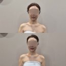 (주)바른약품 | 대구신부관리 더에스테틱수미원 대구달서점 The작은얼굴케어 후기