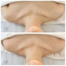 엑스포로(유성-62) | 대전 유성 피부관리샵 다얼에스테틱 신부관리 전신관리 알포유테라피 효과 후기