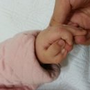 왼손 엄지 다지증/아산병원/소아정형외과 윤준오 교수님 이미지