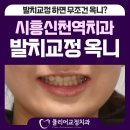 SR프라자 | 시흥신천역치과 발치교정 때문에 옥니 될까 불안하다면