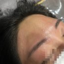 부산 서면 헤어라인왁싱으로 고민해결한 후기