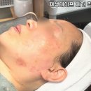 봄스피부과의원 티스토리