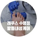 메디아치아카데미 | 부산내성발톱 레푸스수영점앤바바네일 내성케어 받은 후기