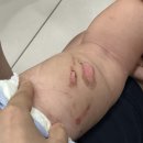 연세새살의원 이미지