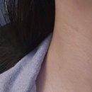달뜰목 | [플라닉프로서포터즈] 플라닉프로 한 달 사용 before/after 변화 후기 (PLASMA·EP·EMS)