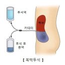 말기 신질환 이미지