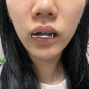 턱 틀어짐 교정 제발 이렇게 해요! -25년차 치과의사