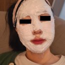 행복약국 | [서울/합정] 편평사마귀 레이저 제거 후기