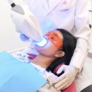 엘리트덴탈 | [리얼 후기] 엘리트덴탈에서 치아 미백 받아봤어요 – 효과 있을까?