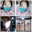 성모하늘빛안과내눈건강식품 | 급성 녹내장수술후기 1 에피소드& 눈꺼풀 꺼짐현상