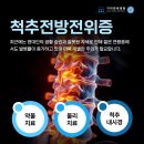 인천서구신경외과 무거운 가방을 매는 습관, 만성요통이 심해지는 이유는 이미지