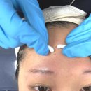 6632 | 강동구 피부관리 고은결에스테틱 트러블관리 B코스 찐솔직 후기