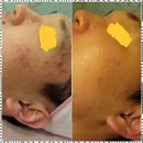 피부천사 네이버블로그