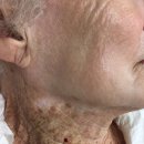 40년 이상 목에는 선크림을 바르지 않은 92세 할머니.jpg 이미지