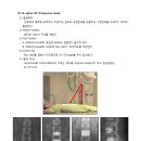 천장관절염 (Sacroiliitis) 이미지