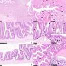 차넬메기의 Plesiomonas shigelloides 이미지
