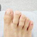 메디컬풋케어페디베어상동점 네이버블로그