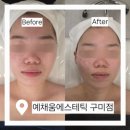 예채움에스테틱