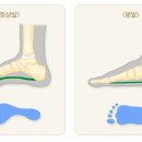 정메디케어 이미지